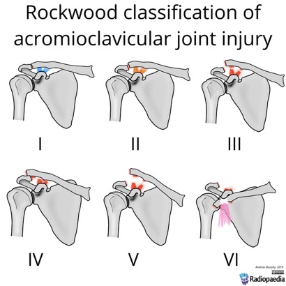 rockwood